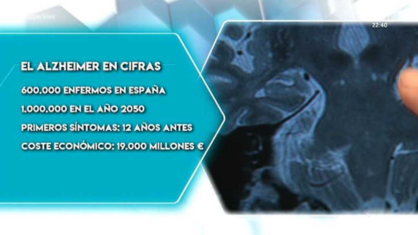 Saber vivir - 21/09/17 - ver ahora