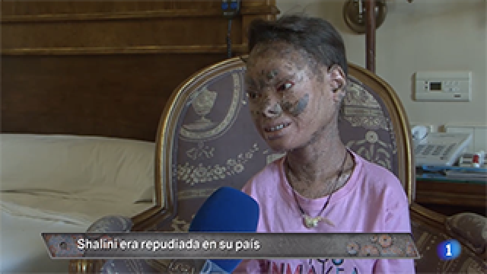 No os perd�is el caso de Shalini, la llamada "ni�a serpiente". La entrevistamos en EXCLUSIVA y lo debatimos con los doctores que han tratado a la joven. #HoraPuntaTVE