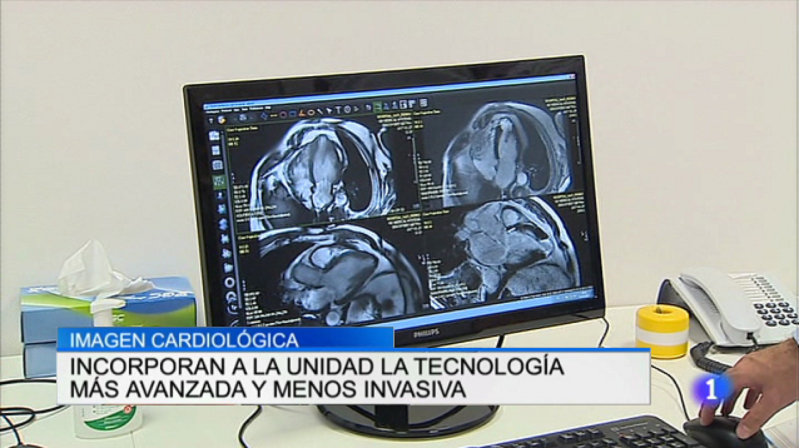 Informativo Telerioja 2 - 02/10/17