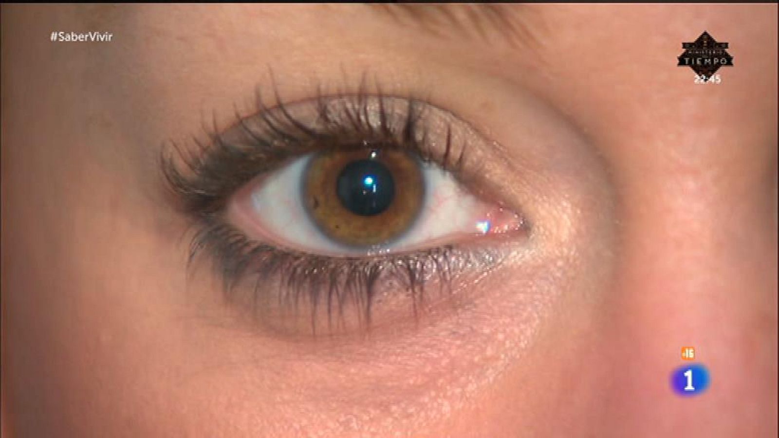 Remedios caseros para las ojeras