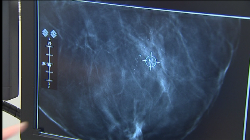 Telecanarias 2 - 19/10/2017