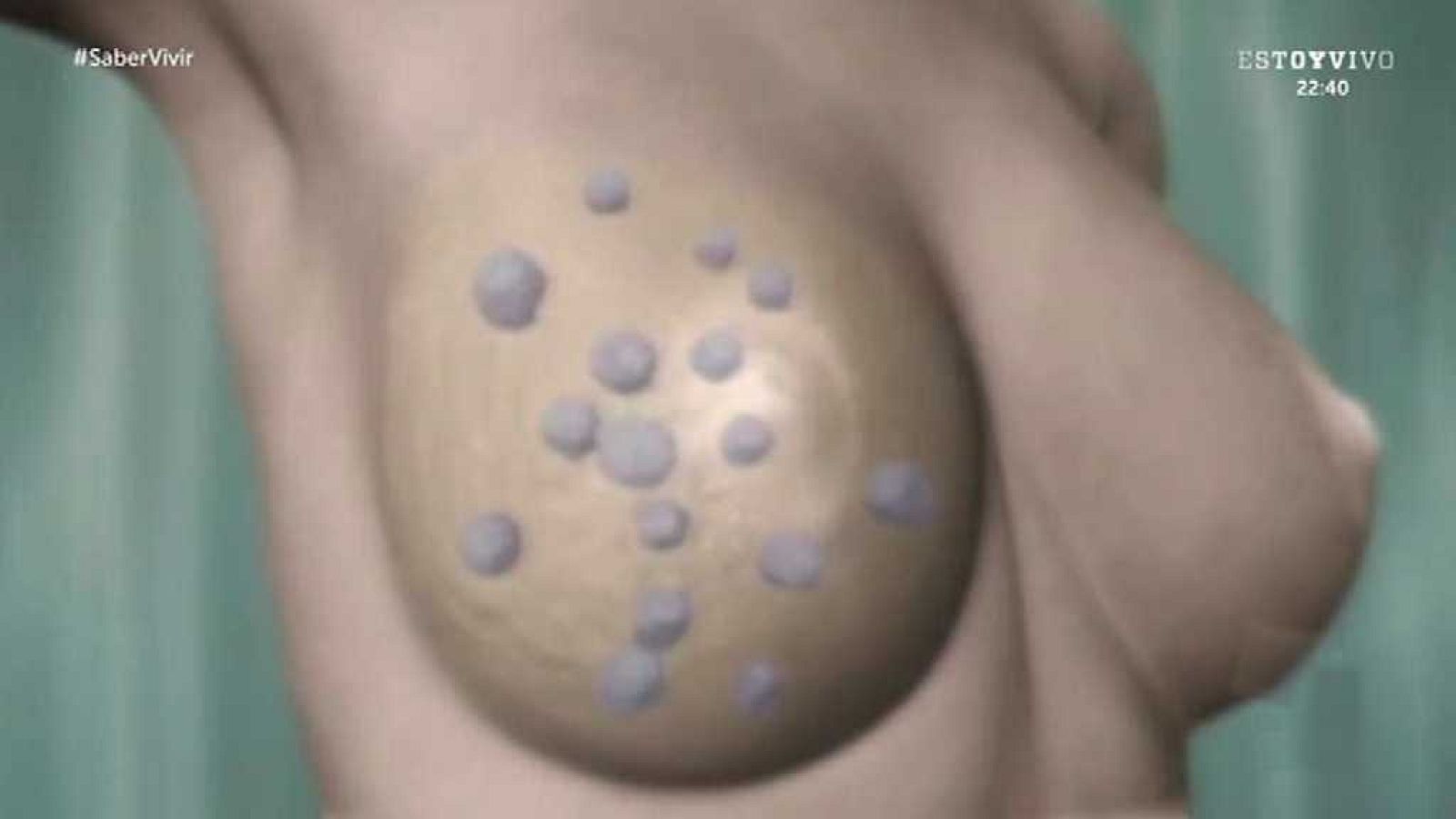 Saber vivir - 26/10/17 - ver ahora