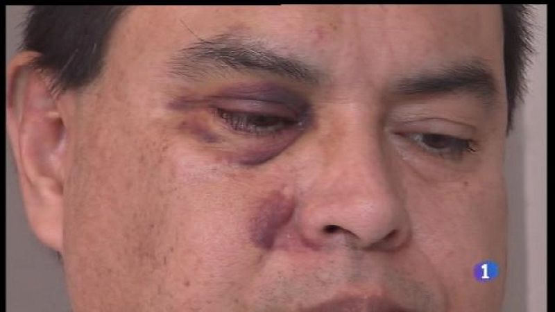 Informatiu Balear - 31/10/17