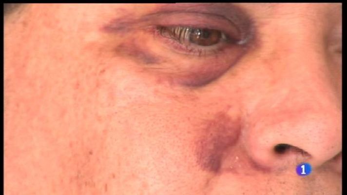 Informatiu Balear - El metge de Muro que va ser agredit per un pacient.