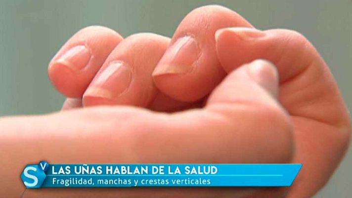 Saber vivir - Saber vivir - 13/11/17