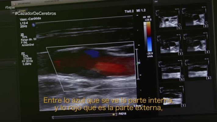 El cazador de cerebros - El cazador de cerebros - Curarse en salud - avance