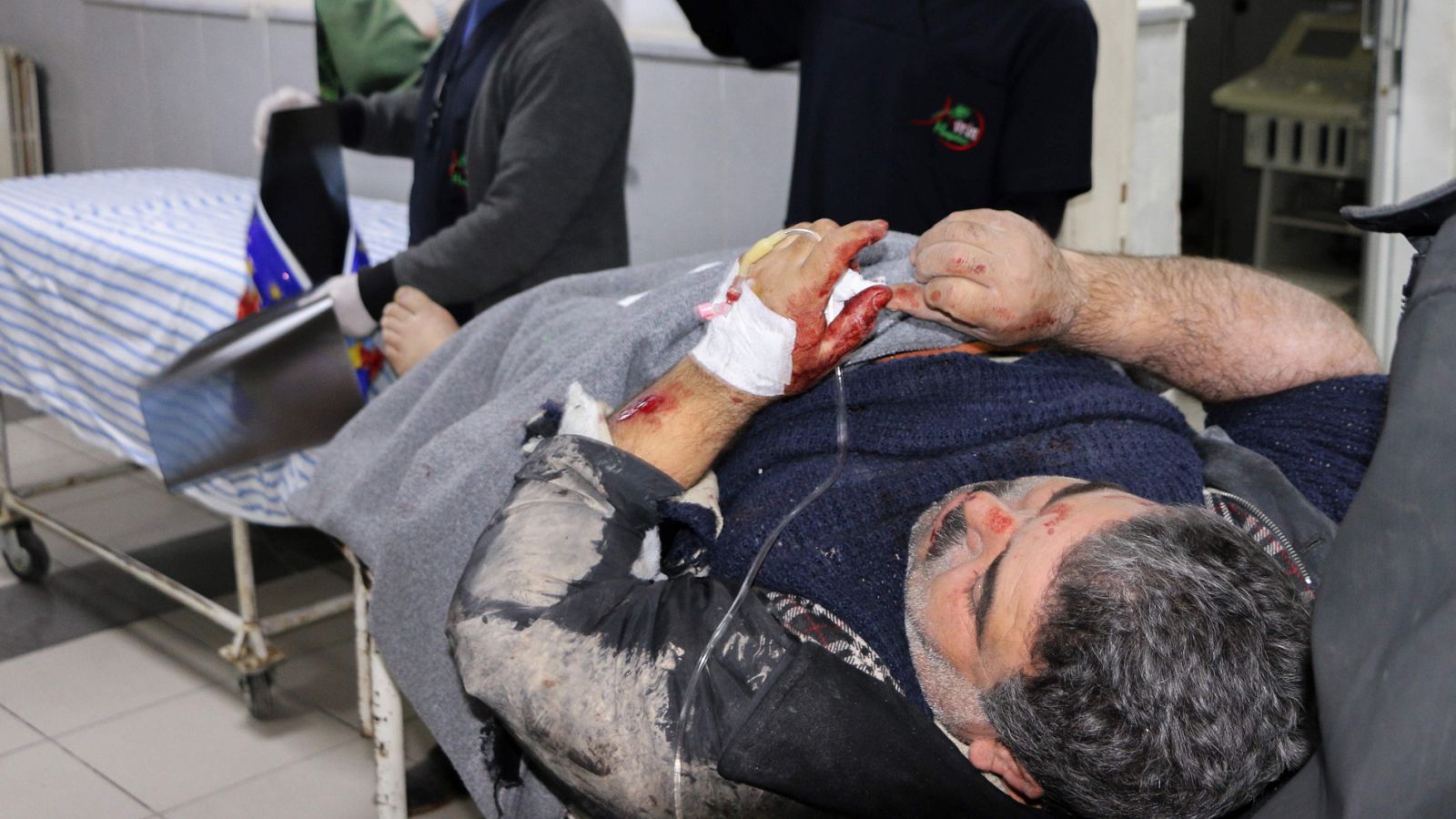 Milicianos kurdos heridos son atendidos en el hospital de Avrin en Afrín