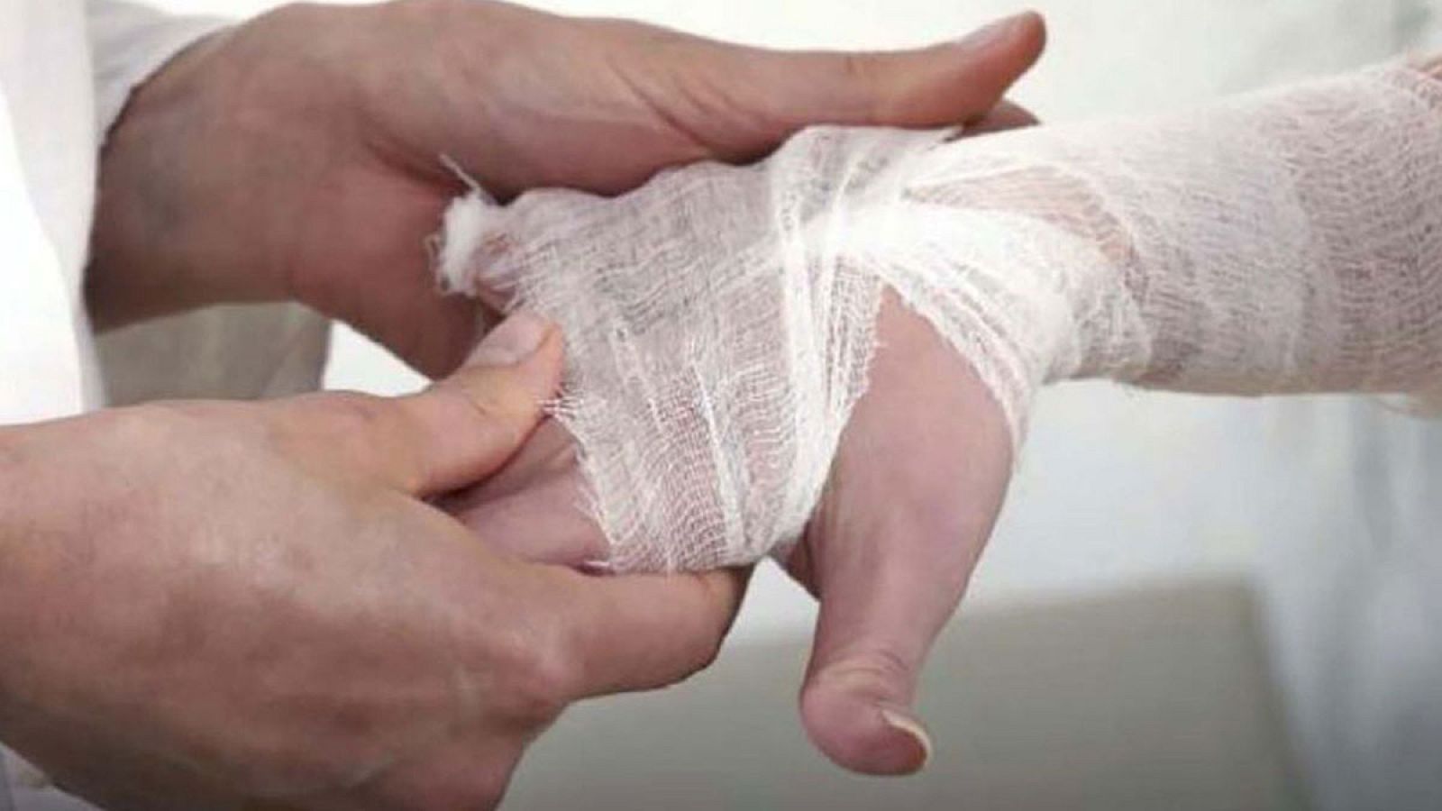 En España la lepra se puede considerar una enfermedad del pasado