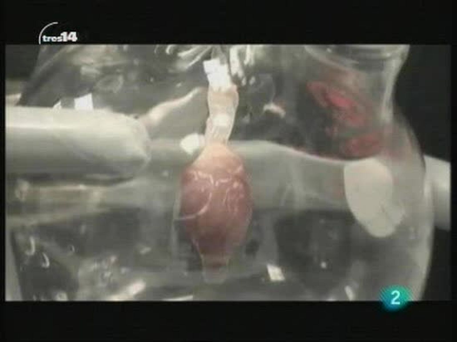 Últimas noticias (Corazón)