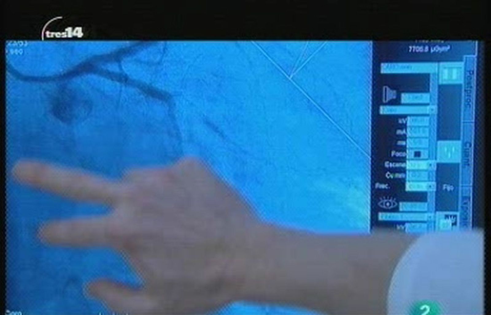 Tres en una (Corazón)