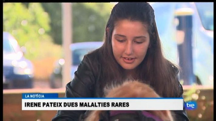 Informatiu Balear - Fins a 70.000 persones a les Balears podrien tenir una malaltia rara