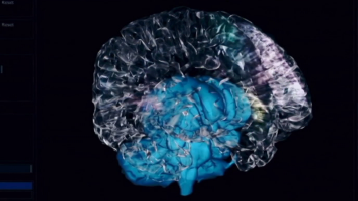 Zoom net - Música neuronal; 18:9 y doble cámara; Playstations Talents