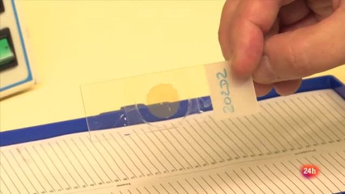 Repor - Recuento de fibras de amianto en los pulmones