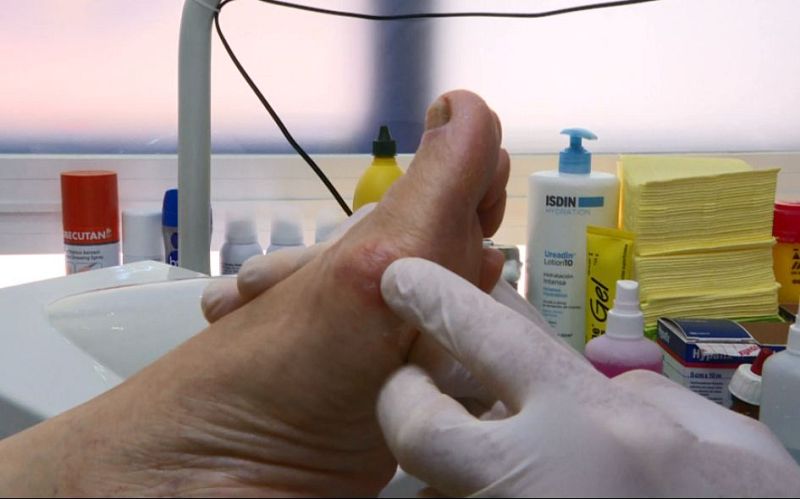 Repor - Pies para que os quiero