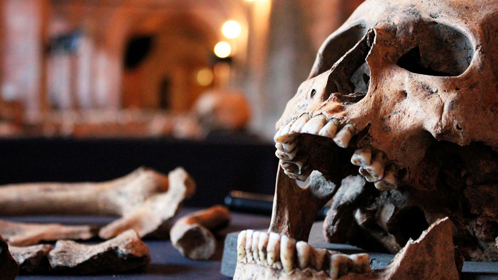 Documenta2 - El regreso de la Peste Negra - ver ahora