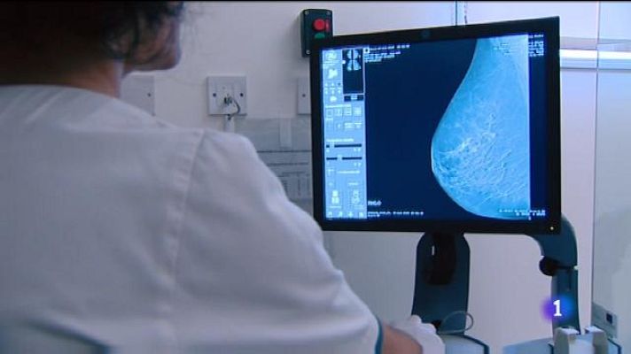 Informatiu Balear - Avui és el dia mundial de càncer de mama. A les Balears 500 dones són diagnosticades cada any.