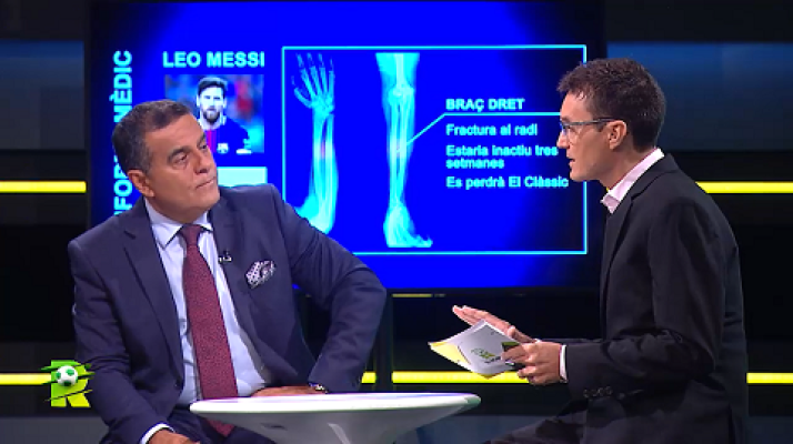 El rondo - Analitzem la lesió de Messi