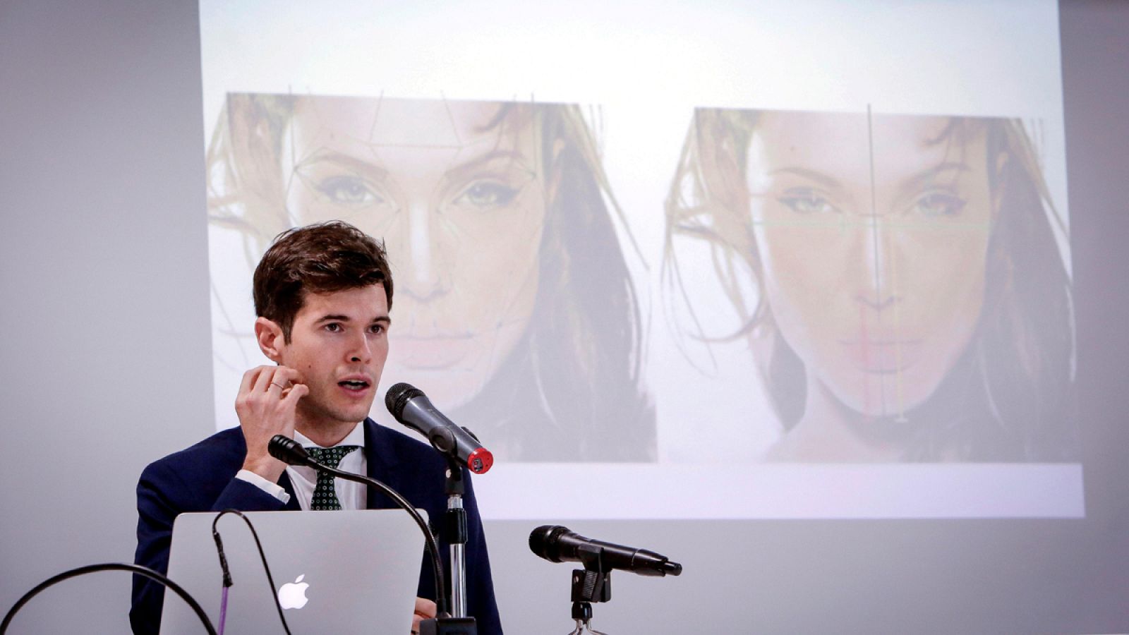 Un equipo médico de Valencia realiza un cambio de sexo en una única cirugía de 17 horas | Ver