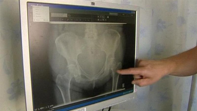 Canarias en 2' - 28/11/2018