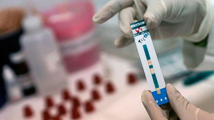 La 2 Noticias - El diagnóstico temprano, clave para la calidad de las personas infectadas de VIH