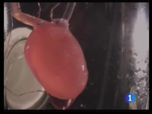 Ciencia y tecnología en Rtve.es - Células madre en los transplantes