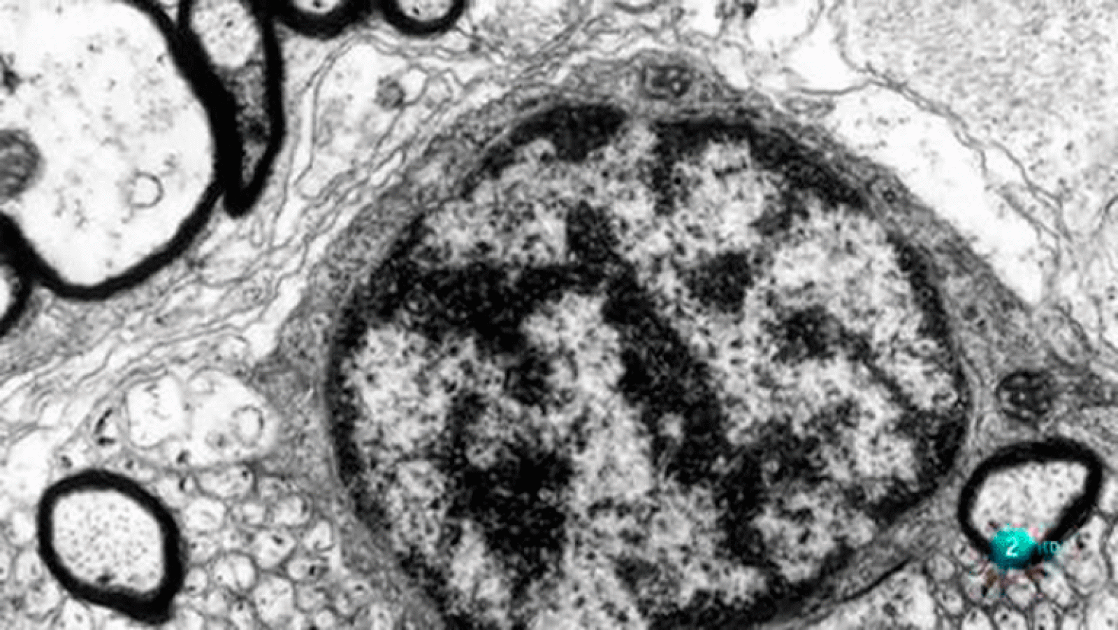 ¿Qué son las células gliales? La aventura del saber La Universidad Responde. Universidad Autónoma de Barcelona