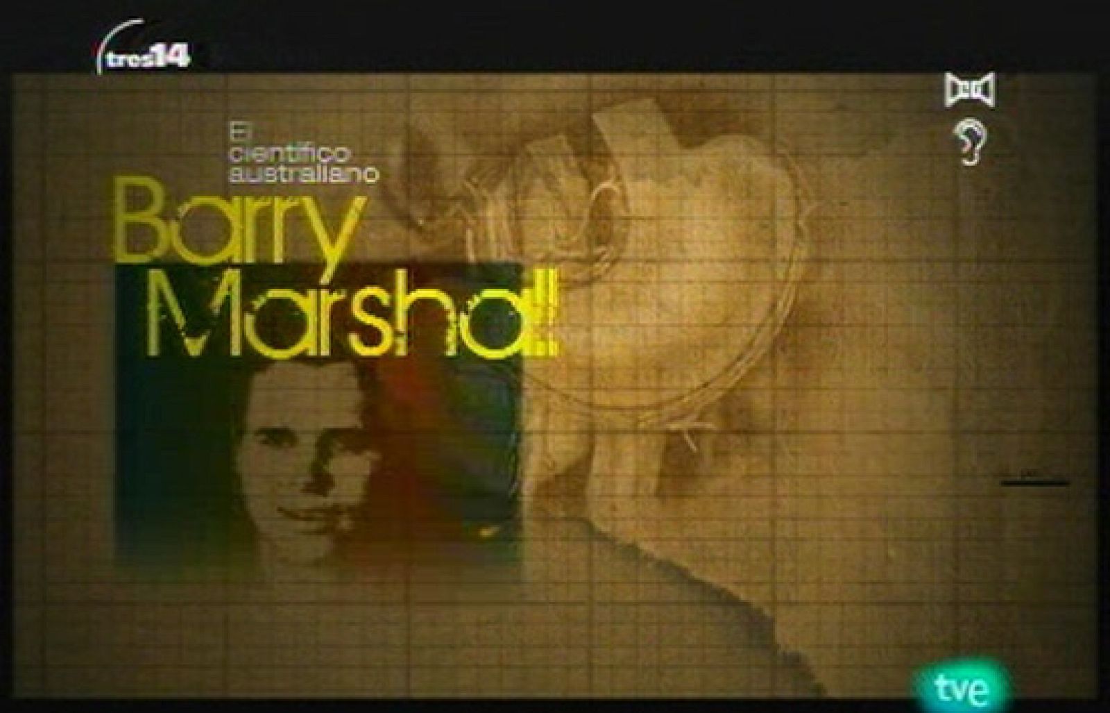 la Helicobacter pylori (al límite)