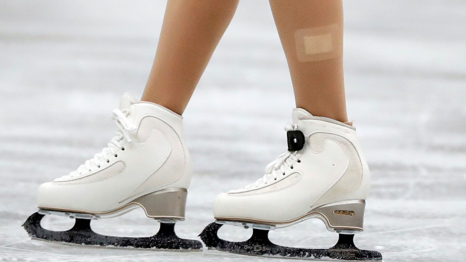 Posible agresión en el Mundial de Patinaje | Ver