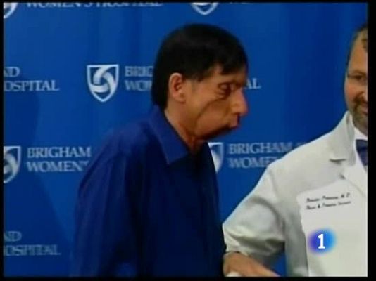 Ciencia y tecnología en Rtve.es - Trasplante de cara en EE.UU