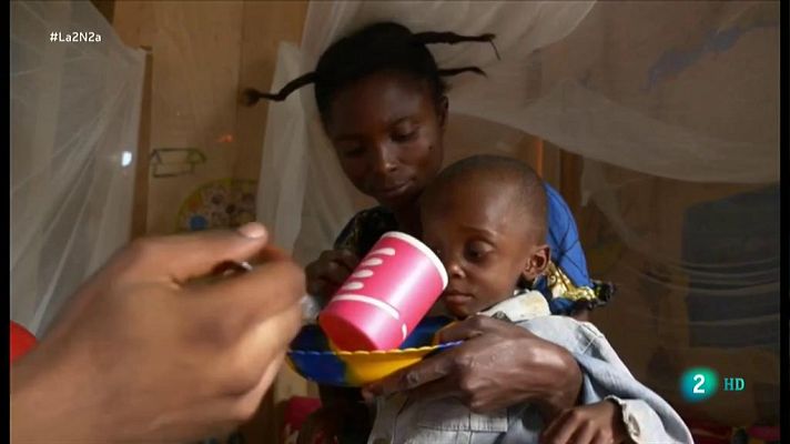 La 2 Noticias - Países con mayor hambruna