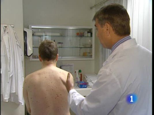 Ciencia y tecnología en Rtve.es - Día Europeo del Melanoma