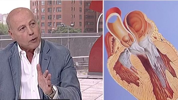 Informativo 24h - El doctor Corbalán: "No es prudente competir como profesional después de un infarto"