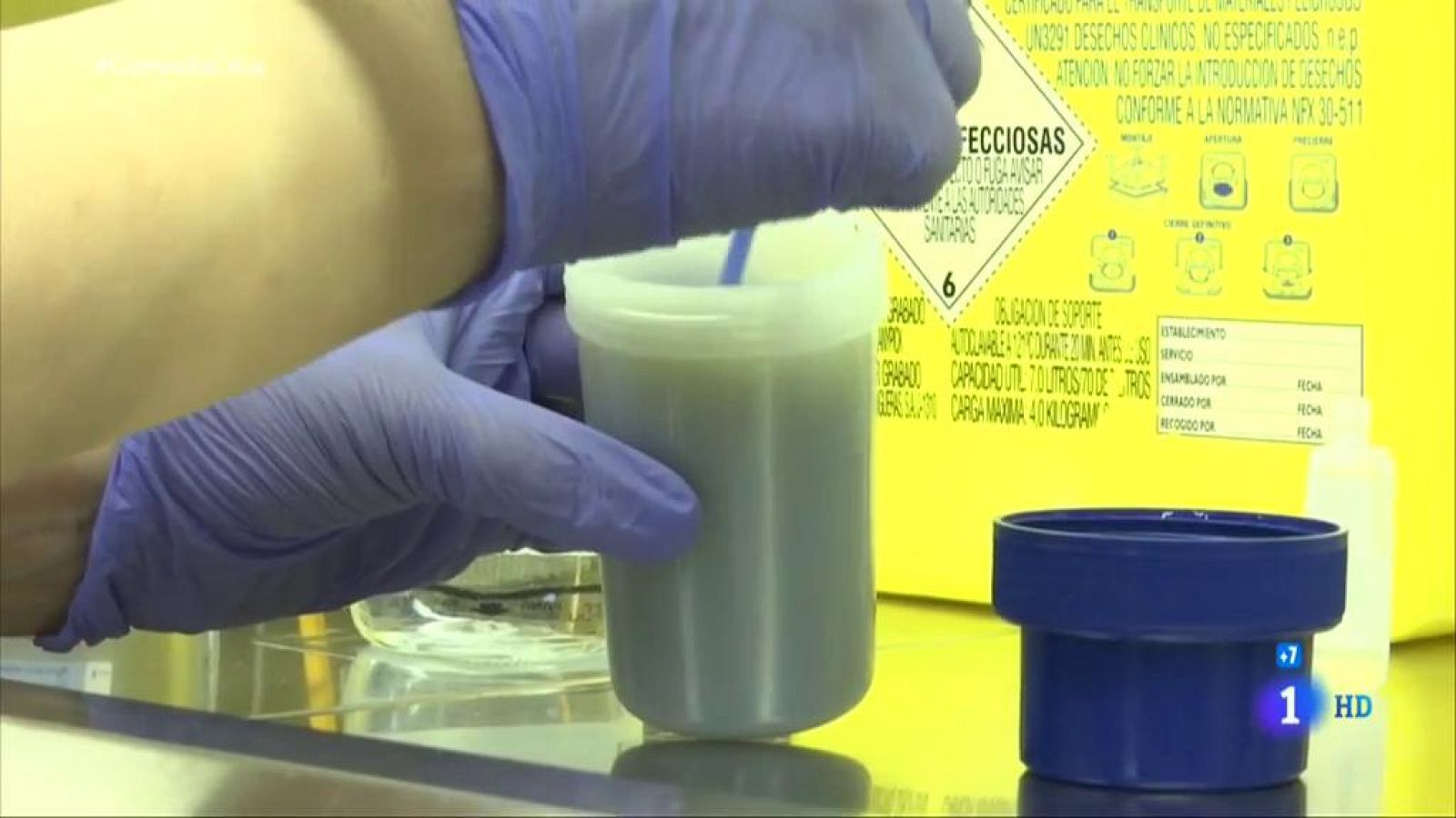 Comando actualidad - Lo que esconde la caca - Trasplante fecal