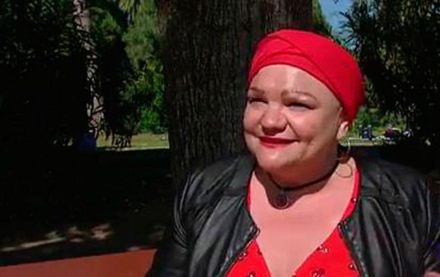 Telediario 1 - Visibilizar la calvicie: mujeres que no quieren esconderse