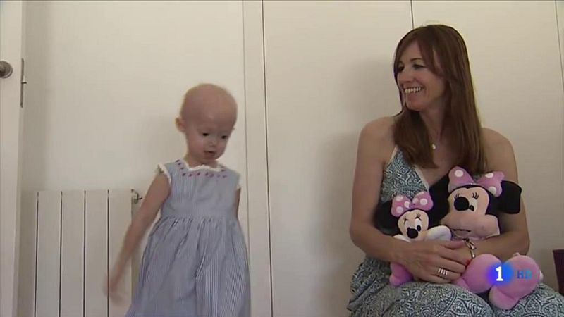 En el mundo hay 120 niños que padecen progeria