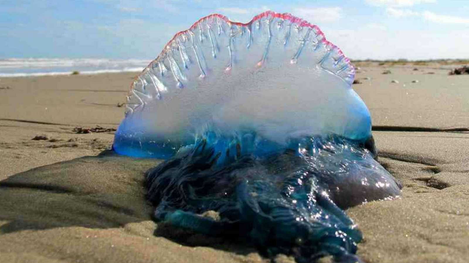 Ingresada por la picadura de una carabela portuguesa | Ver