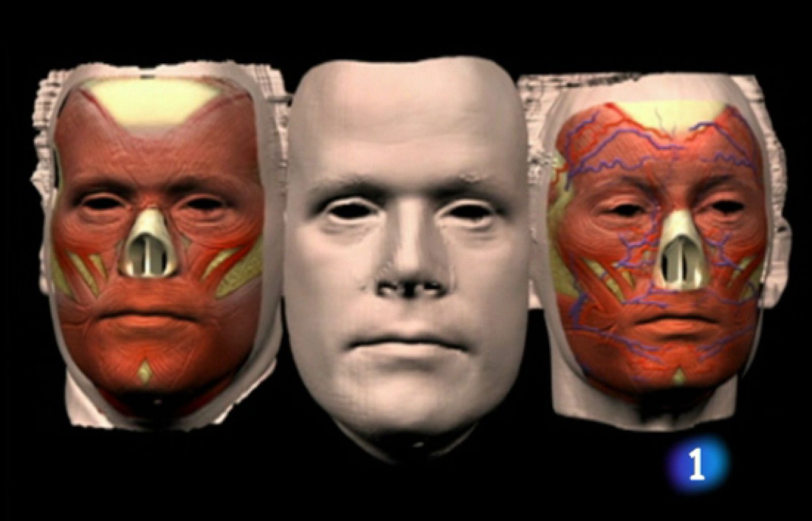 La Comisión de Trasplantes ha  autorizado los dos primeros trasplantes de cara en España. - Ciencia y tecnología en Rtve.es | Ver