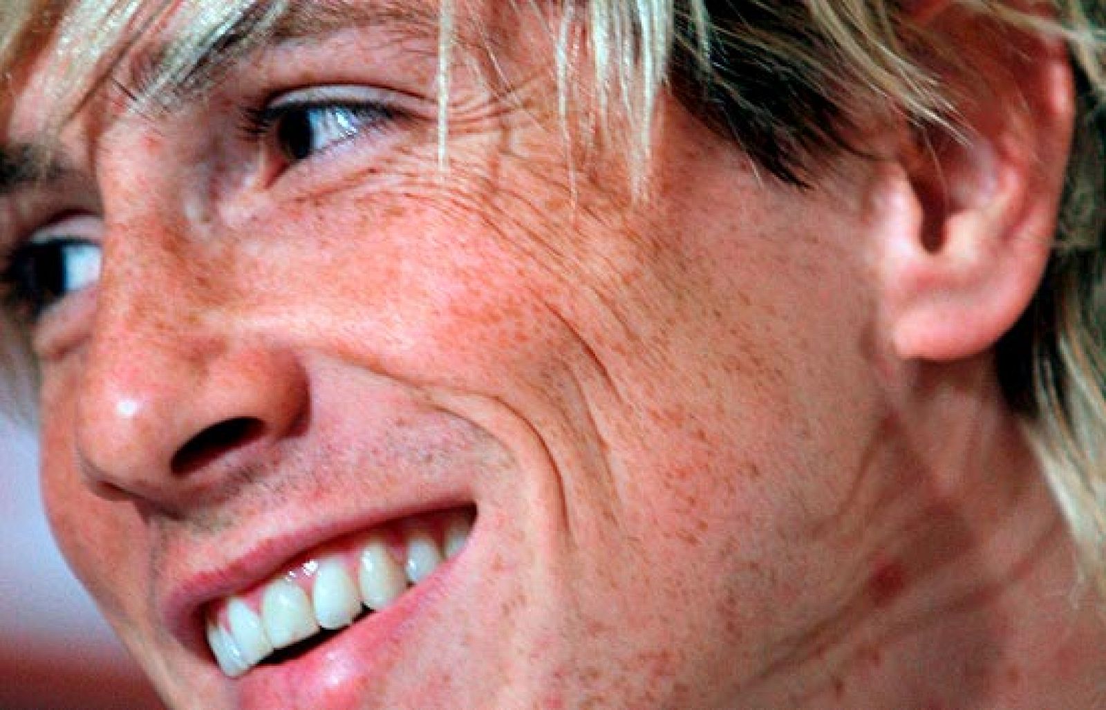 'La derrota nos servirá para el Mundial' | Ver