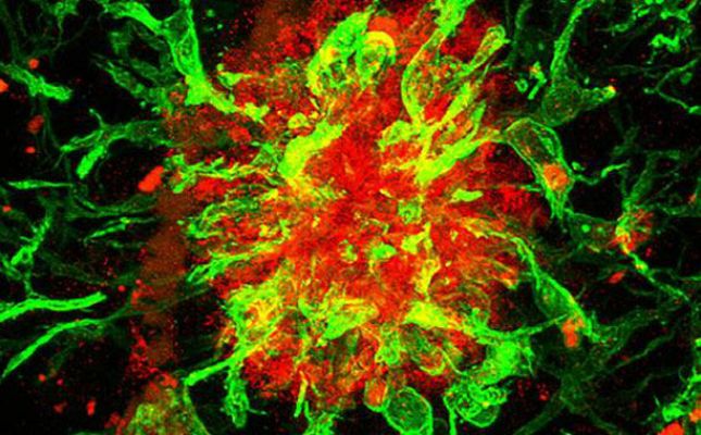 Telediario 1 - Descubren una nueva diana terapéutica para el tratamiento del alzhéimer en ratones