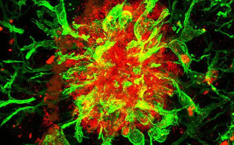 Descubren una nueva diana terapéutica para el tratamiento del alzhéimer en ratones