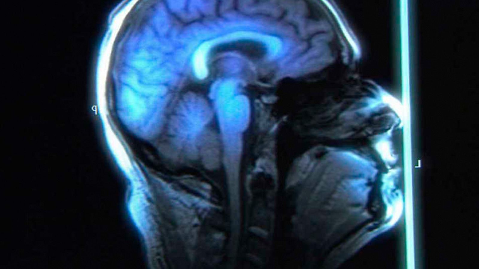 La noche temática - La plasticidad del cerebro. Cambia tu mente  - ver ahora