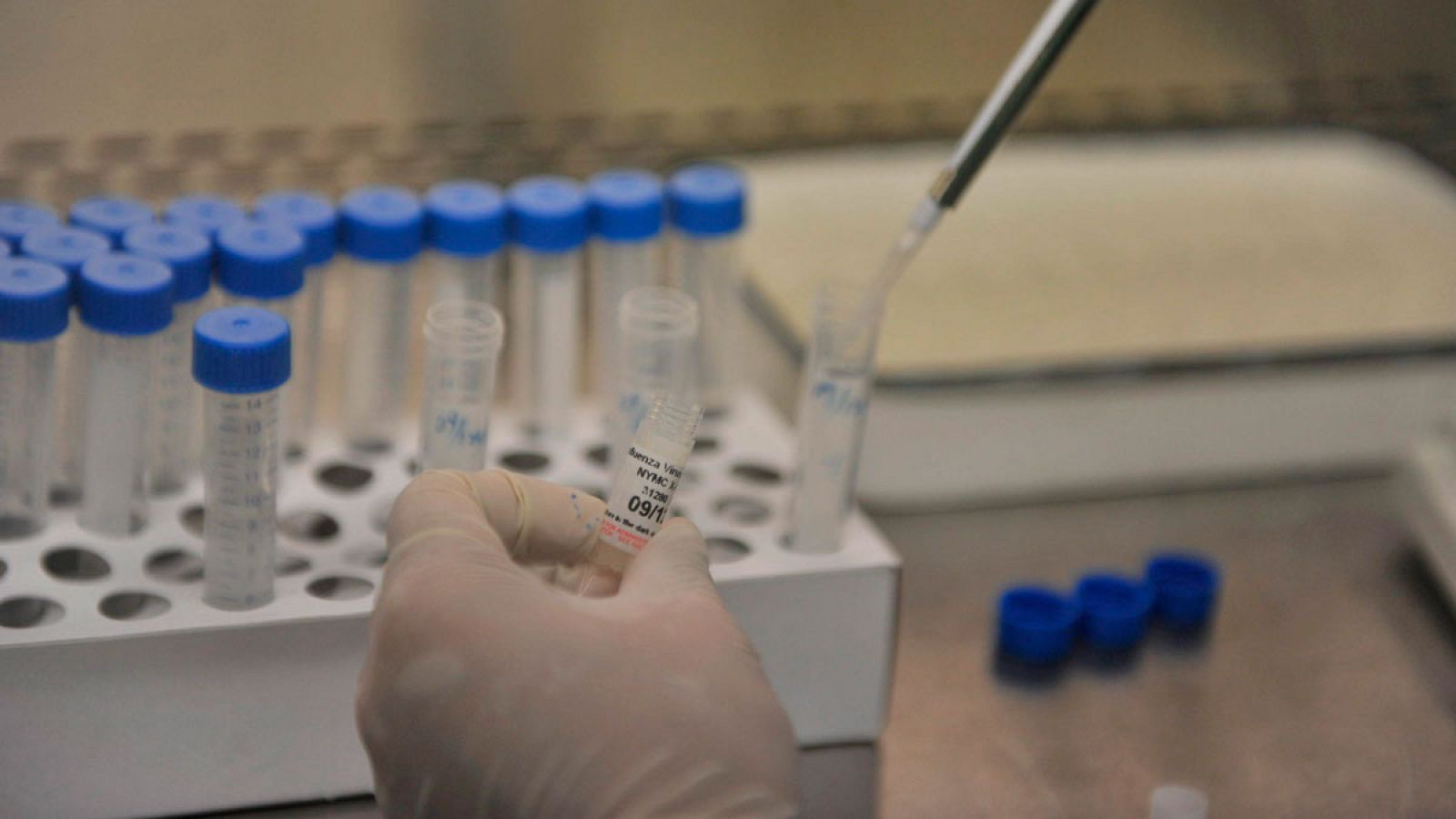 Un paso más para la vacuna española contra la tuberculosis | Ver