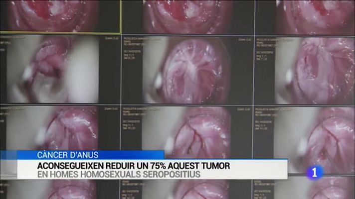 L'Informatiu - L'Informatiu - 01/10/2019