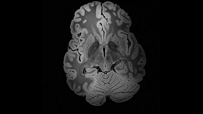Lab24 - Exclusivamente Alzheimer y Climatizar en el rtico - ver ahora