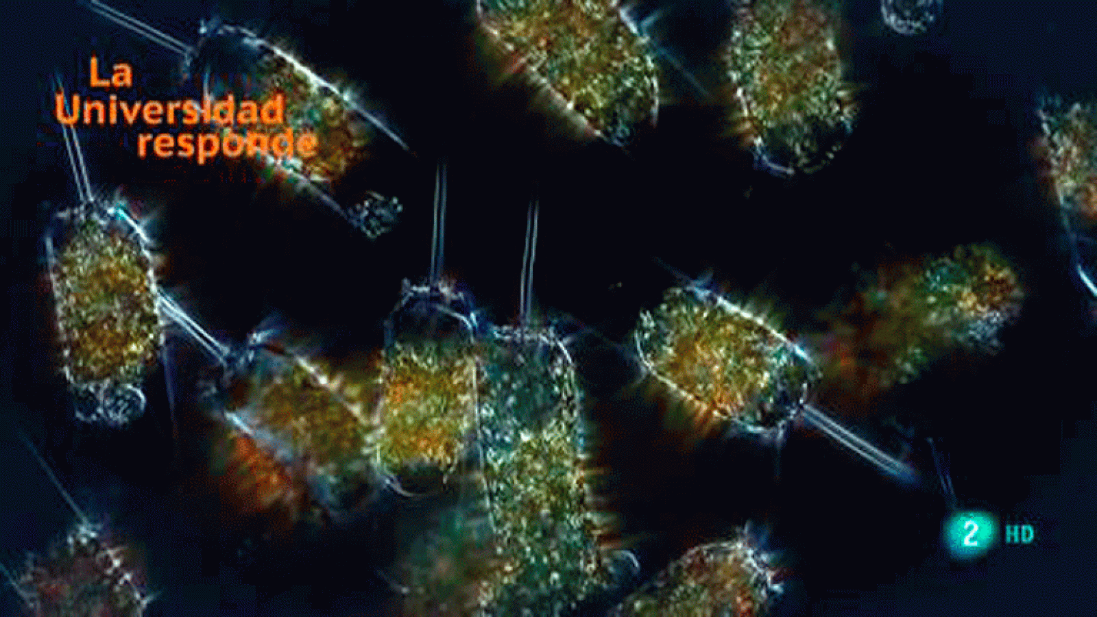 La aventura del saber ¿Qué es el fitoplancton? Universidad de Vigo. La Universidad Responde.