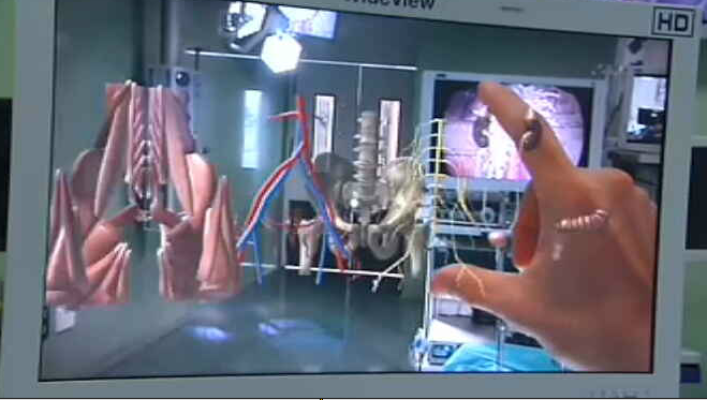 Lab24 - Reportaje - Mínima invasión, máxima innovación