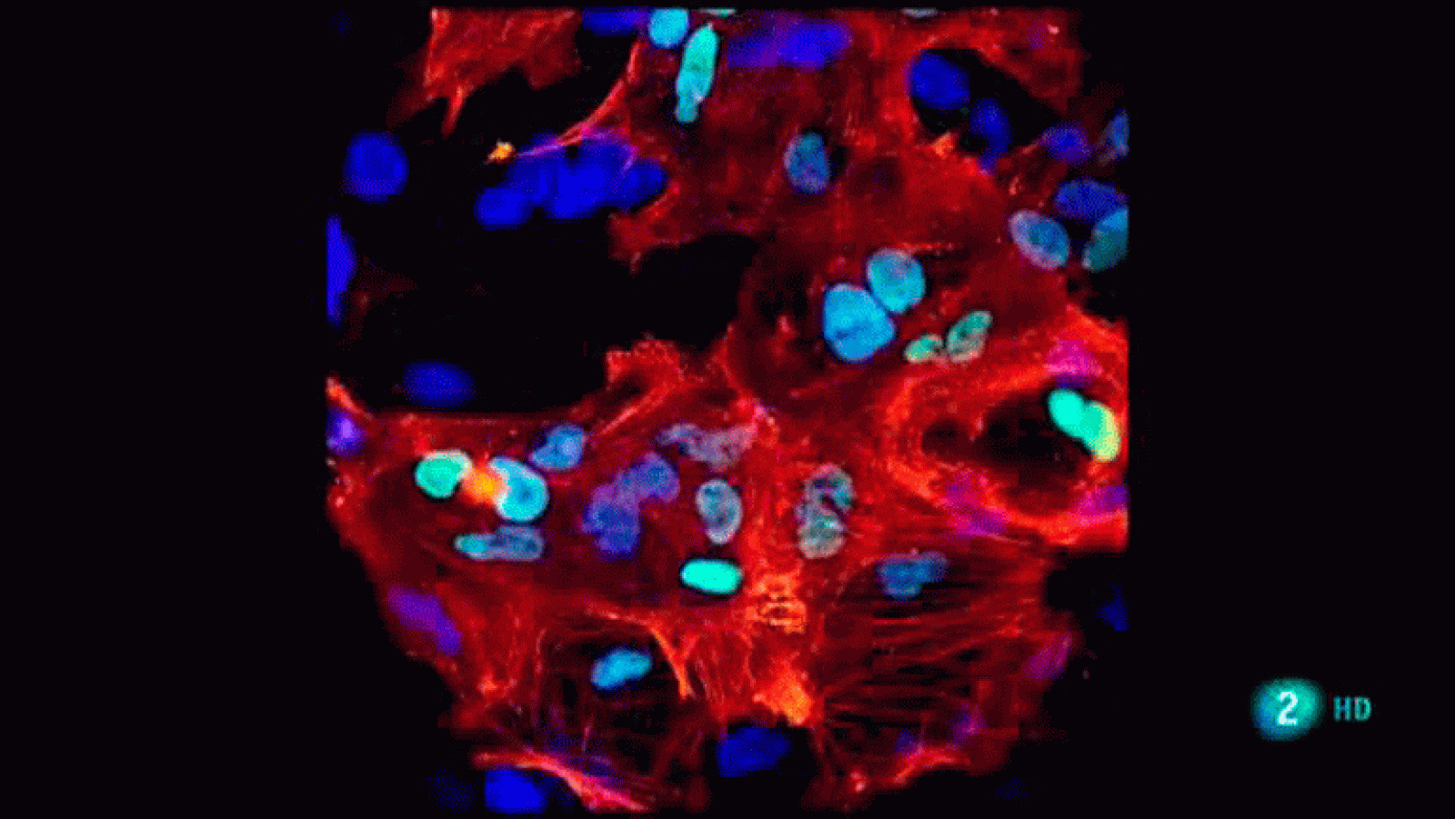 La aventura del saber En el futuro ¿qué enfermedades podrán tratarse con terapia celular? Universidad de Barcelona. La Universidad Responde.