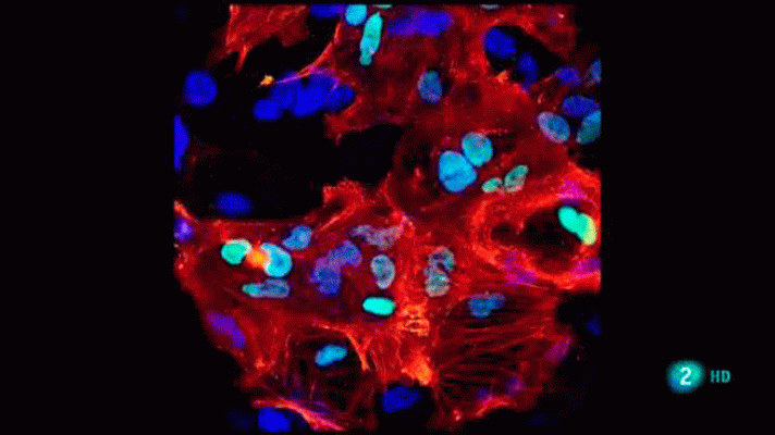 La aventura del Saber - ¿Qué enfermedades podrán tratarse con terapia celular?