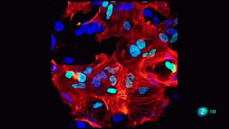 La aventura del saber. En el futuro ¿qué enfermedades podrán tratarse con terapia celular?