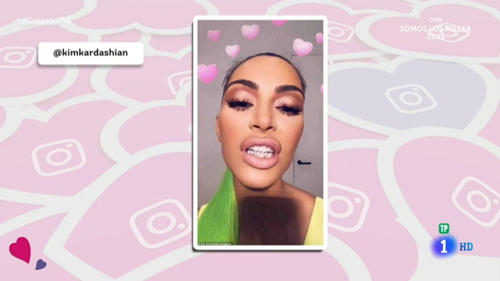 Corazón - Famosos y el bling bling dental - D Corazón | Ver